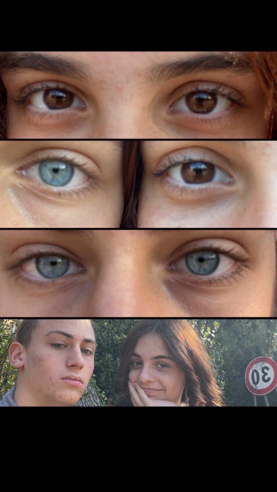 Trend degli occhi andato male